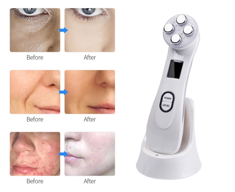 LED Facial Toning Device